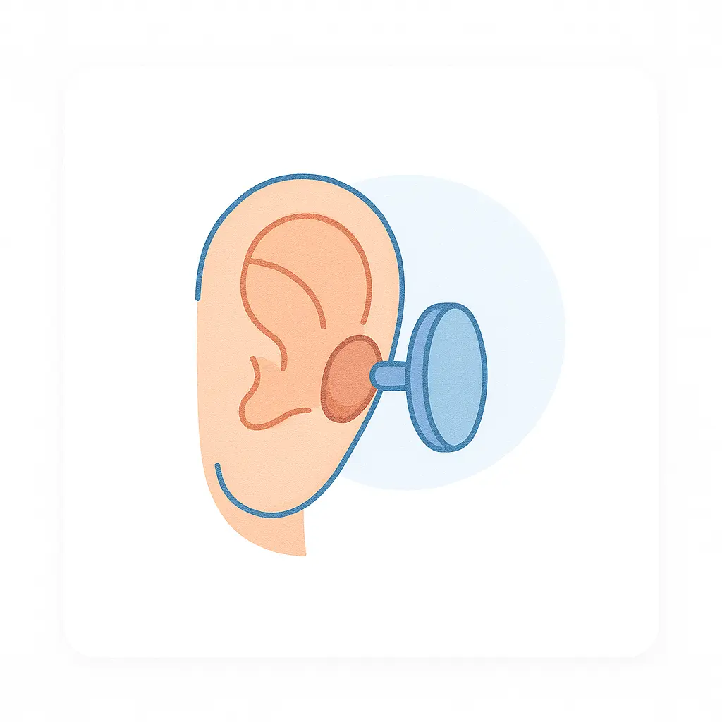 Close-up clinical photo of ear keloids on the earlobe, showing raised scar tissue and typical appearance of ear keloids.